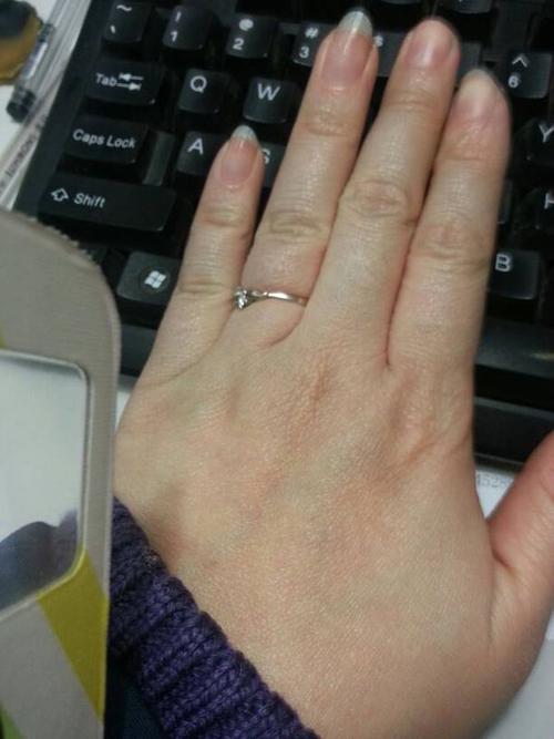 双手手指发青,请问什么病?