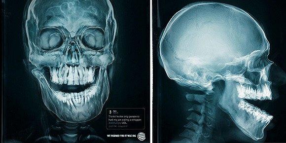 消费者吃皇堡吃到下巴脱臼,汉堡王却洋洋得意