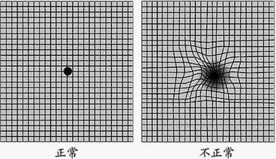 1张图测试你的眼睛是否正常,看出男人则安全,看出女人