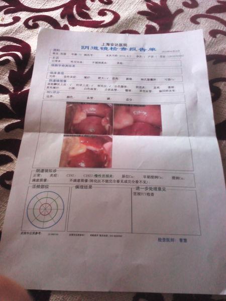 子宫有小肌瘤,医生说很小,会有问题么?