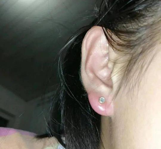 网友吐槽打耳洞的第二天,耳朵已经肿的像弥罗佛了,评论纷纷出妙招