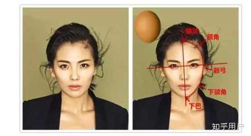 那些做了颧骨内推的现在怎么样了?