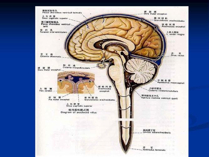 蛛网膜下腔出血