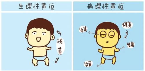 (3)听,视功能电生理检查:脑干听觉诱发电位,闪光视觉诱发电位