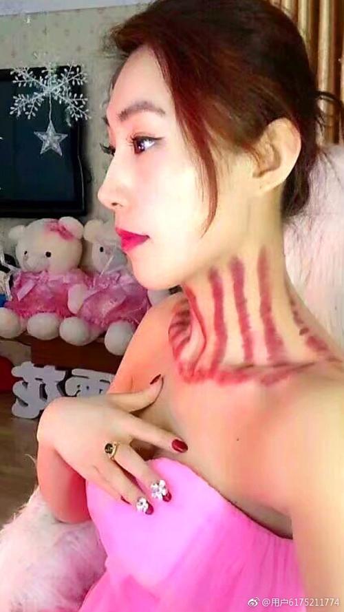 [转载]我享受揪脖子美妙的全过程_紫痧缘_新浪博客