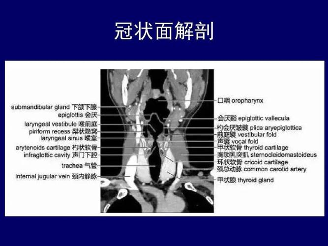 收藏史上最全的ct断层解剖图谱一篇所有都有