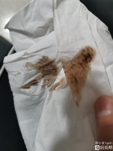 怀孕六周左右一直断断续续褐色分泌物量不