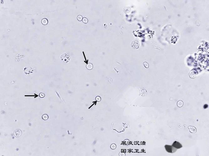 白细胞 请报告箭头所指图像的名称 (未染色标本)