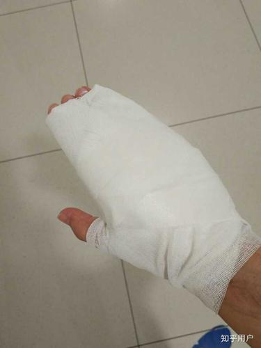 烫伤前后皮肤的具体变化是怎样的?