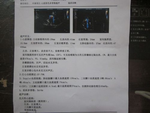 三尖瓣中度返流,32岁,男,没症状要治疗不?