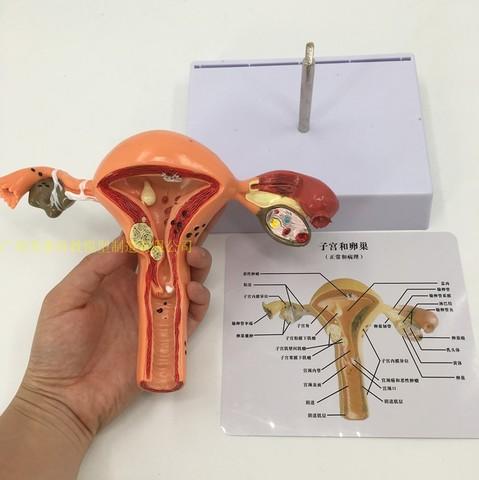 医学教学 模型直销:人体模型女性生殖子宫阴道卵巢子宫教学模具病理