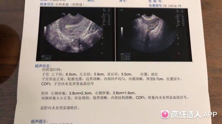 [试管婴儿]自然流产3天,阴超显示流干净了,但内膜7毫米医生说偏厚