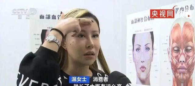 注射生长因子导致毁容一年后她的脸变成了长方形