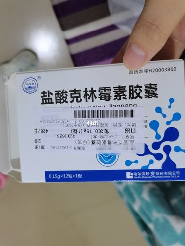 银屑病  口服药  盐酸克林霉素胶囊副作用_银屑病_医疗健康_医疗药品