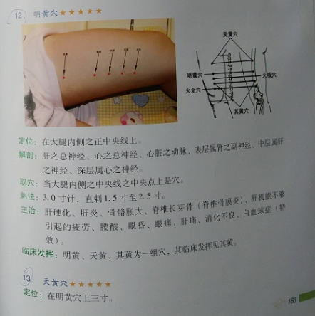 中医针灸穴上三黄穴是哪三个穴
