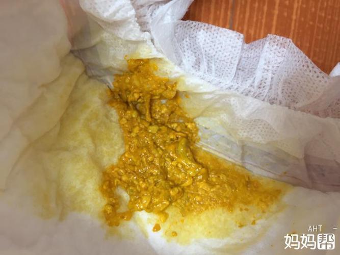 拉水样便便,一条一条的,粘粘的鼻涕样