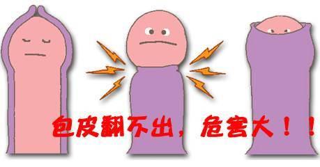关于包皮过长的危害,别再胡乱猜想了