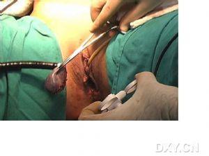 自然腔道可以包括口腔,肛门,,尿道,阴道,虽然各大研究组织具体操作