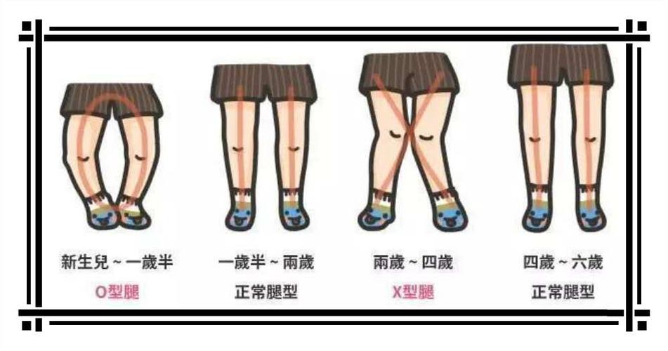 真正毁宝宝腿型的元凶是这些!
