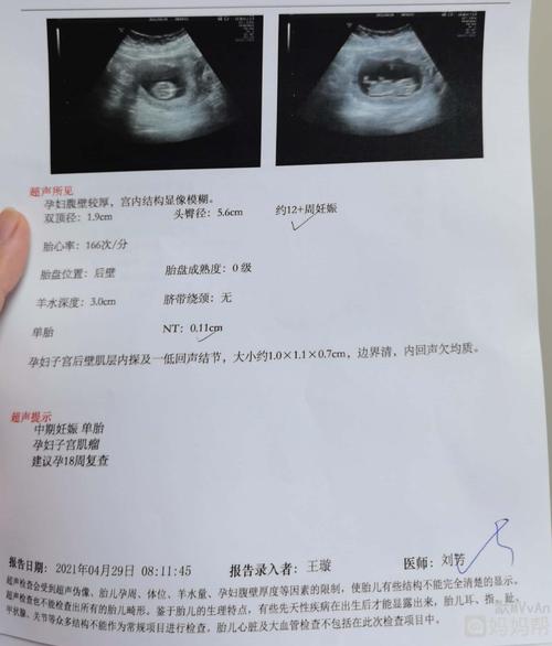 nt已过,看看男孩女孩?一胎男孩,这是二