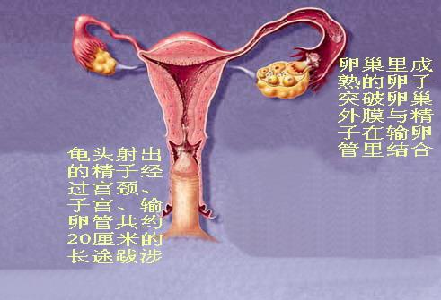 精子与卵子结合后再移师子宫腔内着床