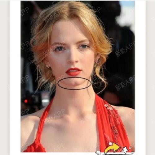 下巴这条沟被称为美人沟,也叫"pp下巴"