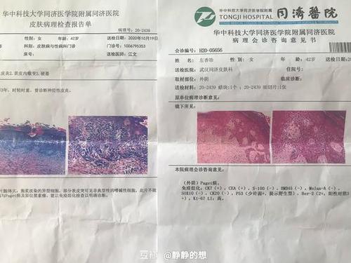左香珍的病理检查报告单.受访者供图