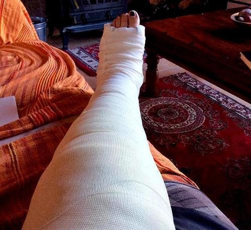 半月板损伤石膏制动就能好?医生辟谣,详述不同损伤的治疗措施