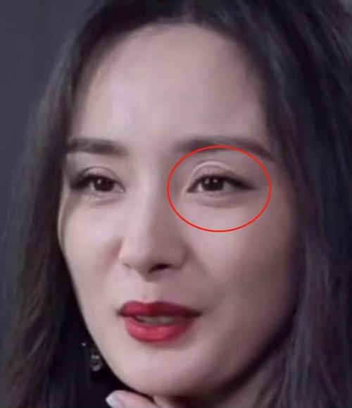 杨幂近照显老态,眼睛上方有奇怪褶皱,莫非是整形后遗症?