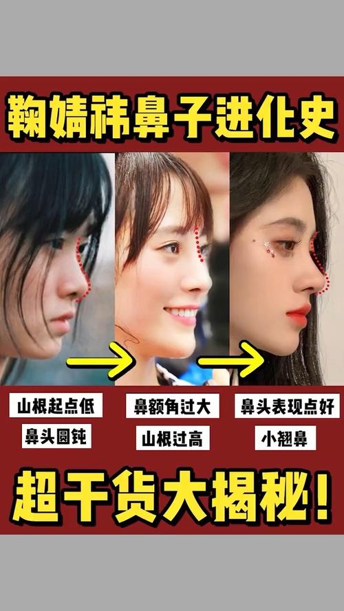 超详细揭秘鞠婧祎鼻子变化史 精致小翘鼻