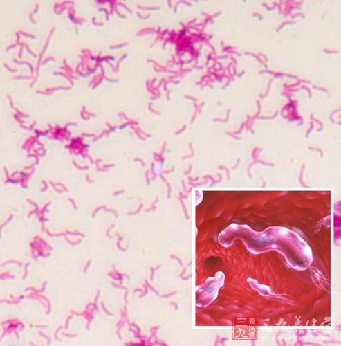 医院感染非发酵革兰阴性杆菌的分布与耐药性分析
