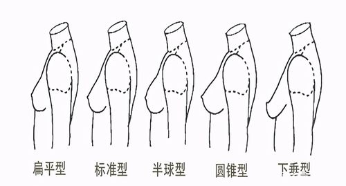 女性胸型分析