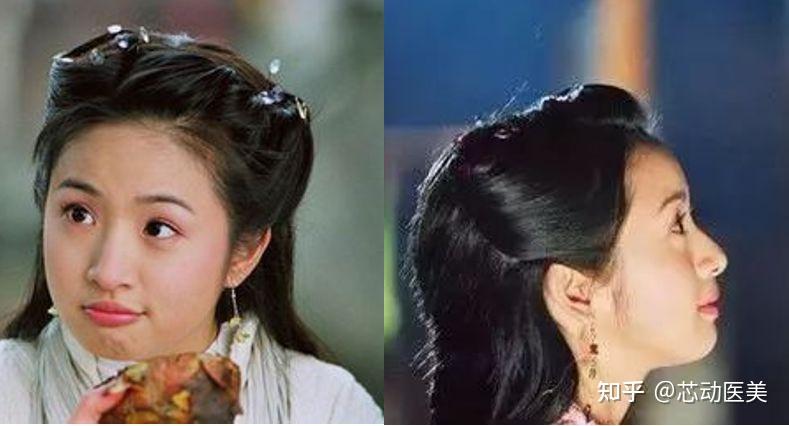 可爱风妹子衰老后会变成林依晨吗