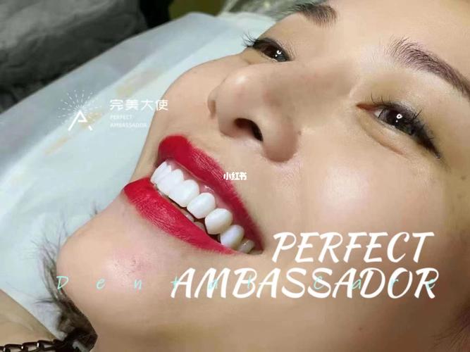 完美大使牙齿美白_美牙_牙齿美白_美妆_医美整形