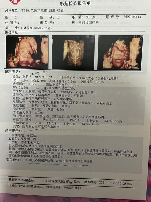 听说四维彩超能看出男孩女孩?朋友说我的是女孩不知道准不准!