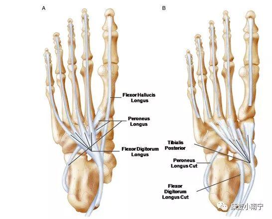 足部的主要足底韧带为足部的纵向和横向提供被动稳定性    (二)动态