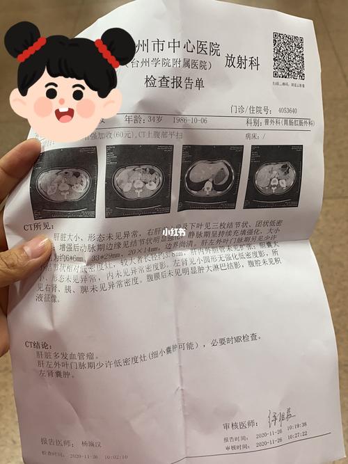 肝血管瘤_肝脏血管瘤_医疗健康_医疗健康其他