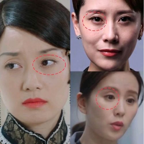99明星逃不了的显老元凶:眼窝凹陷女明星都是长年带
