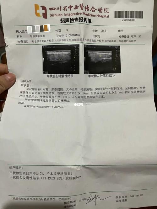 甲状腺_甲状腺_桥本氏甲状腺炎_医疗健康_医疗健康其他