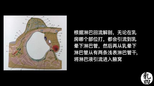 前哨淋巴结活检(slnb)