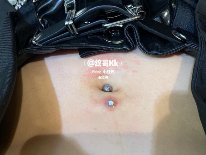疤痕体质的肚脐钉恢复经验|亲测_疤痕_澳宝怎么样_脐钉_百多邦怎么样