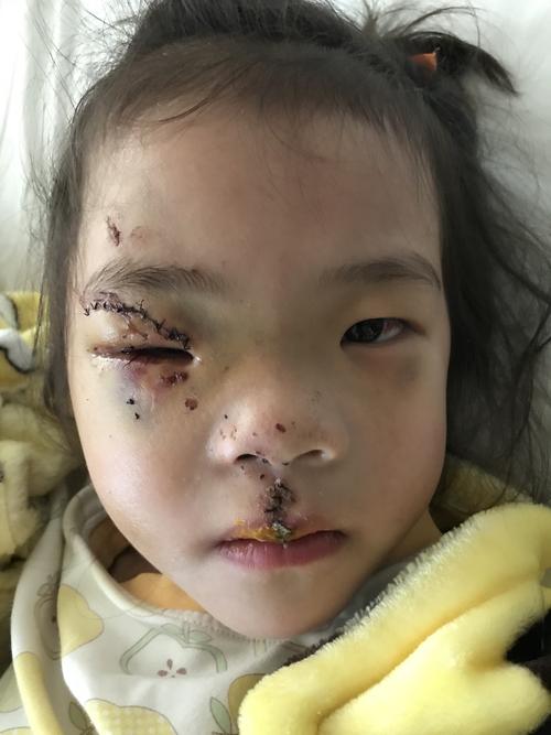 又是骑车,为什么受伤的总是小朋友啊 (原创)