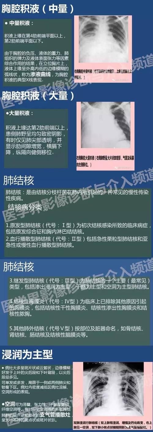 再也不担心读不懂胸片了!