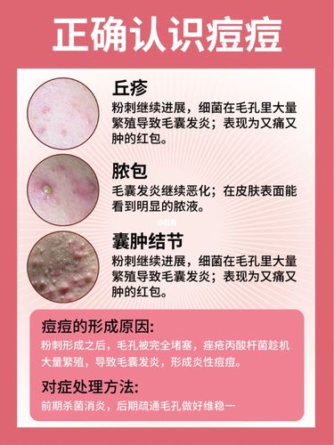 痘痘_毛孔_粉刺_油脂分泌_发炎_夏天去哪玩_美妆_护肤_护肤其他