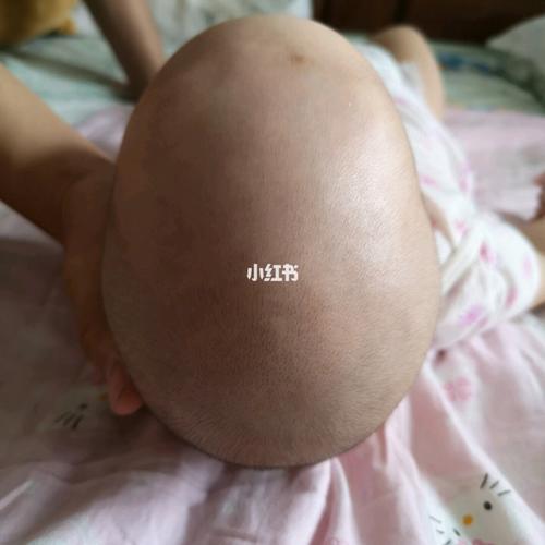 宝宝好像睡成菱形头了_枕头_母婴_育儿经验
