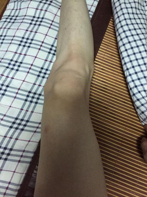 大腿中间有缝啊肿么破. 我说是正常的,我家长偏说我