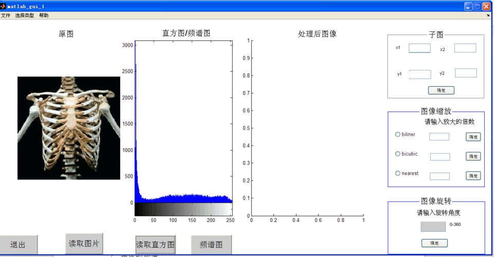 五,结果与分析 1,图像直方图均衡化