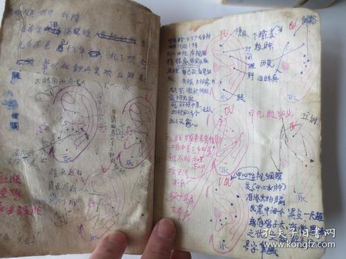 老中医耳针特效疗法,经验 手写资料10册(作者亲手治疗