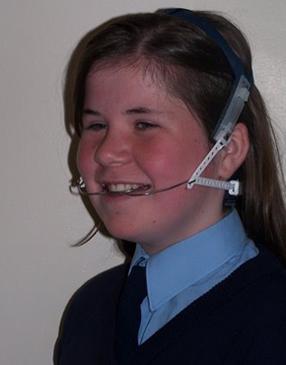 患者佩戴口外弓如下图