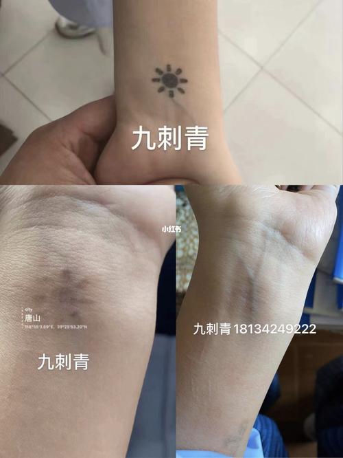 洗纹身洗两次恢复后效果图_纹身_洗纹身_美妆_彩妆